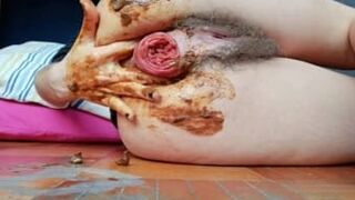 Videos Tagged with prolapse